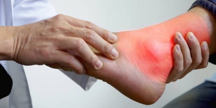 Biar Asam Urat Ngak Kumat, Hindari Konsumsi Makanan ini