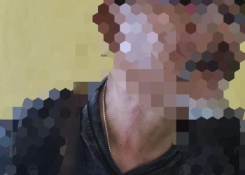 Terkait Dugaan Peganiayaan Oknum Kades Huntuk Kepada Seorang ASN, Ini Penjelasan Polsek Bintauna