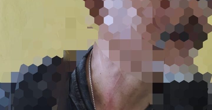 Terkait Dugaan Peganiayaan Oknum Kades Huntuk Kepada Seorang ASN, Ini Penjelasan Polsek Bintauna